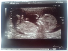 Just for fun... BOY OR GIRL?!