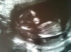 Gender guesses?! Nub theory?