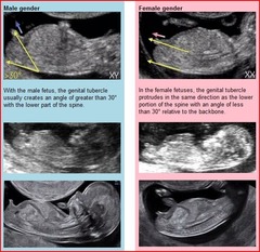 Just for fun... BOY OR GIRL?!