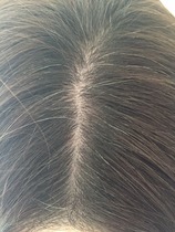 Grey hairs are driving me mad