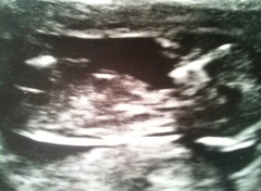 Gender guesses?! Nub theory?