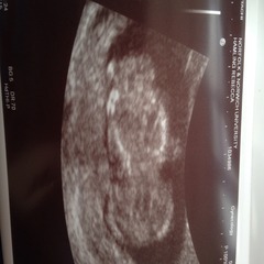 best shit place grass #3. Still pregnant and scans ahoy. End of the year can't come soon enough!