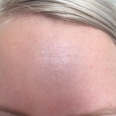 Help sort my skin (pics included)