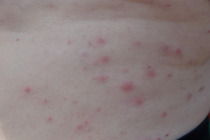 Does anyone know what these spots are?