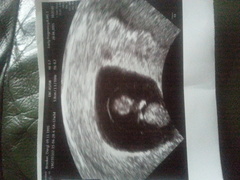 am i 10 weeks or 14 just need something clarified ?