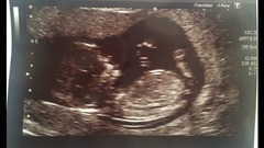 November 2015 mums to be! Here we are! Our bus is decorated with scan pics, our appetites are beginning to heal, and spring is in the air!