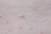 Does anyone know what these spots are?