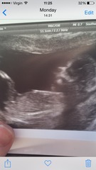 any guesses of the sx of my baby 12 week scan nub theory x