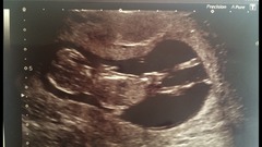 November 2015 mums to be! Here we are! Our bus is decorated with scan pics, our appetites are beginning to heal, and spring is in the air!