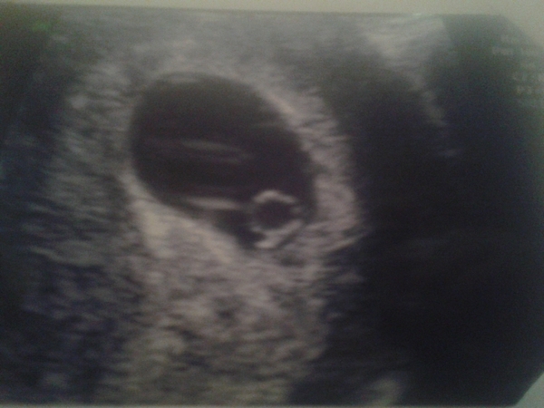 February 2016 - Will the chundering ever cease?!