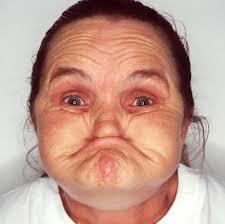 thinking of having a one off botox jab in forehead