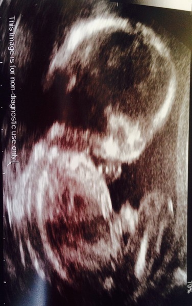 November 2015 Thread - Teams Yellow, Pink and Blue selection has started!