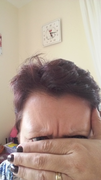 thinking of having a one off botox jab in forehead