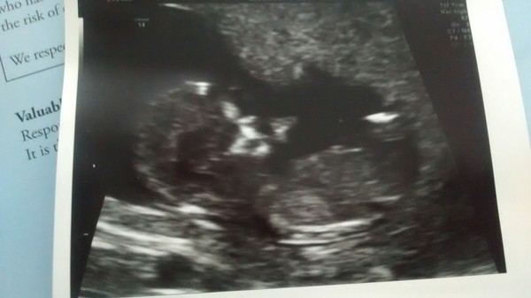 Christmas and new years babies thread!