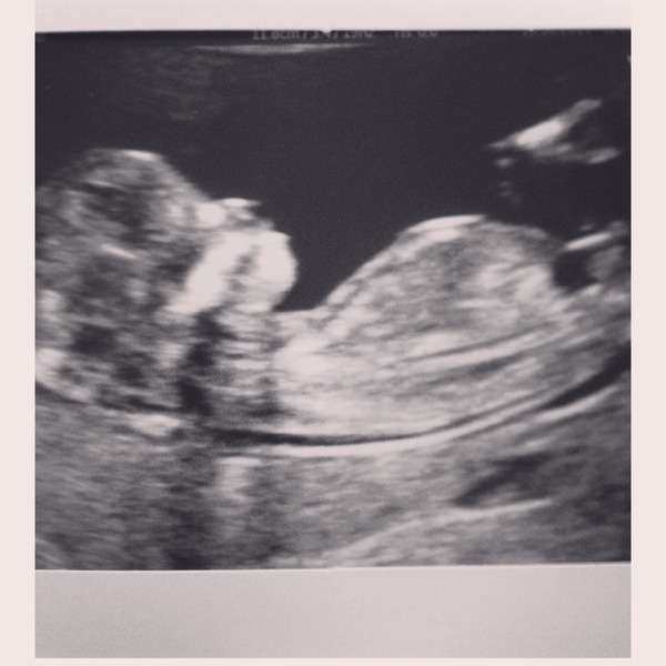 Nub Theory - we really don't care if it's a boy or a girl, but anyone want to guess?