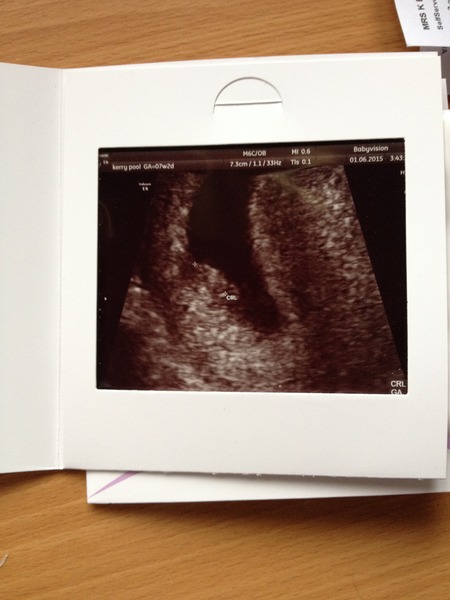 Jan 2016 #4 - heading for the end of the 1st trimester with dating scans and wacky dreams