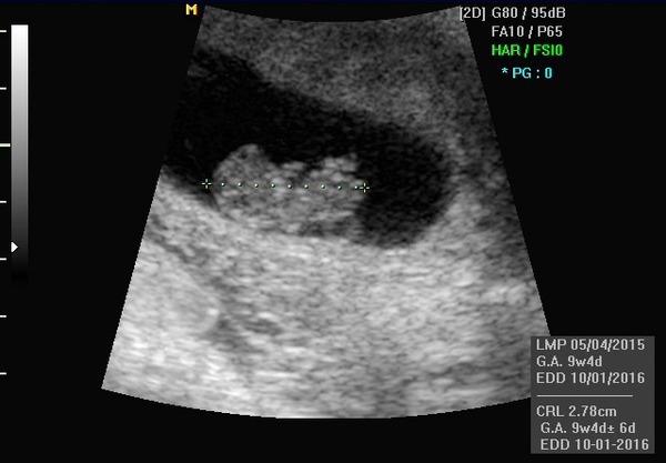 Fang-tastic fannies, Baywatch Blowjobs and good old british summer (arse) rain). It's JSing Grads 30!