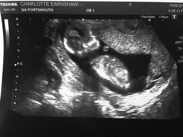 Christmas and new years babies thread!