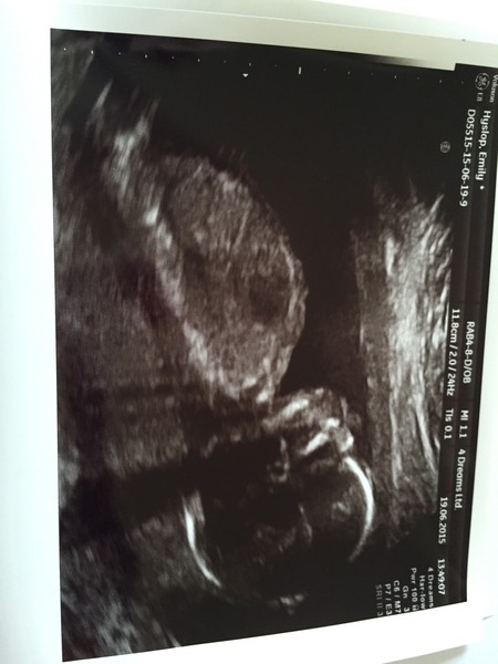 November 2015 Thread - Teams Yellow, Pink and Blue selection has started!