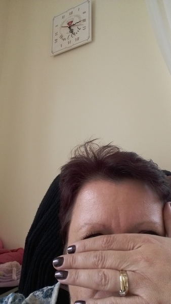 thinking of having a one off botox jab in forehead