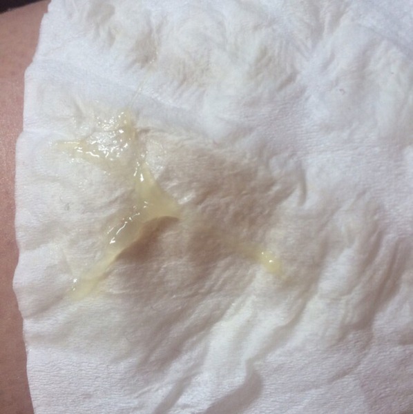 Is this the start of the plug? Sorry TMI!