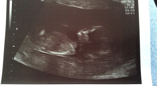 Christmas and new years babies thread!