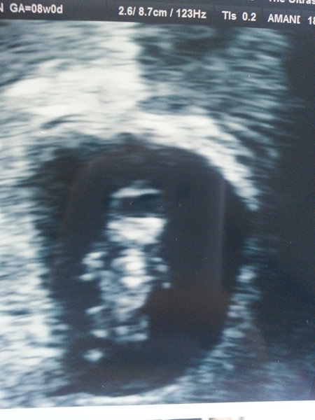 February 2016 babies - the chundering continues