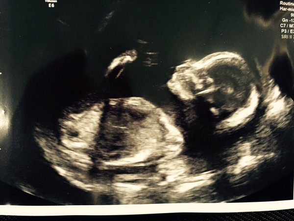 November 2015 Thread - Teams Yellow, Pink and Blue selection has started!