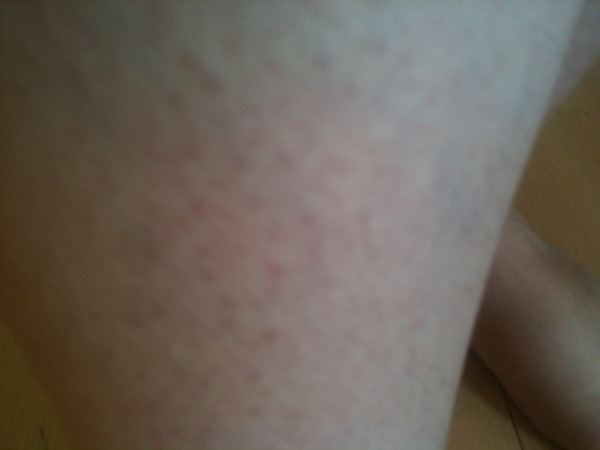 How to improve skin on legs. Includes photo.