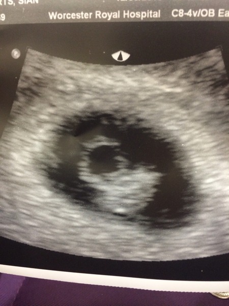 February 2016 babies - the chundering continues