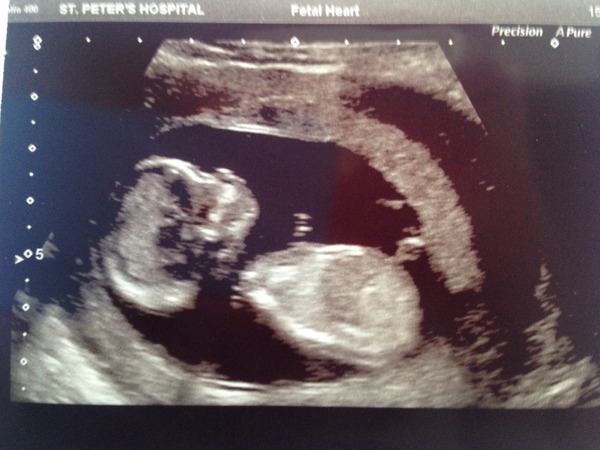 Christmas and new years babies thread!