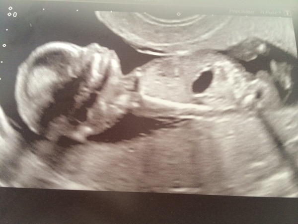 Christmas and new years babies thread!