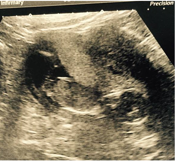 Boy or Girl?
