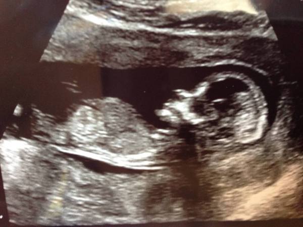 boy or girl?