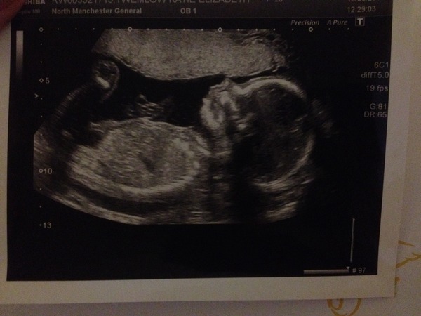 November 2015 Thread - Teams Yellow, Pink and Blue selection has started!