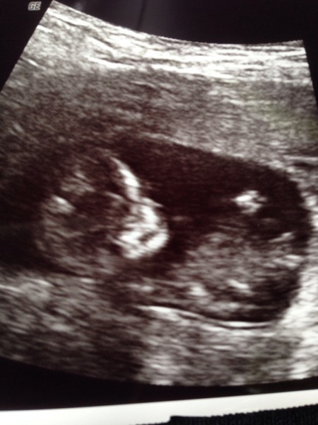 Christmas and new years babies thread!