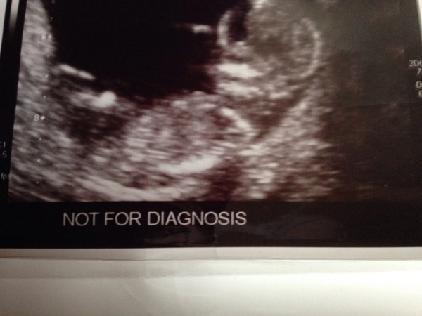 boy or girl?