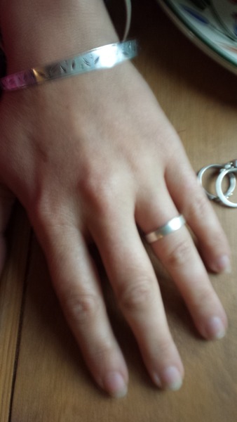 does my finger look fat In this? (ring)