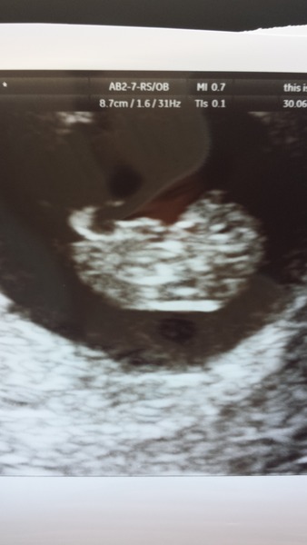 February 2016 - Will the chundering ever cease?!