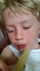Weird rash,poorly DS - help me diagnose please.