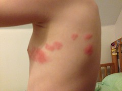 Any ideas please what this rash could be?