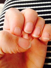 Any tips for sorting out my nails please?