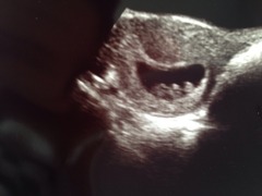 Jan 2016 #4 - heading for the end of the 1st trimester with dating scans and wacky dreams