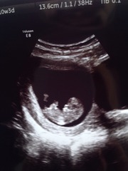 Jan 2016 #4 - heading for the end of the 1st trimester with dating scans and wacky dreams