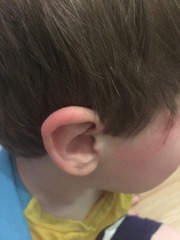 DS came home from nursery sunburnt to f**k. AIBU?