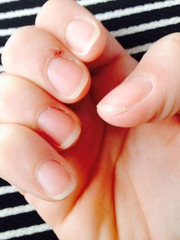 Any tips for sorting out my nails please?