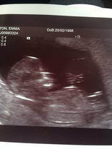 Boy or girl? Nub experts?
