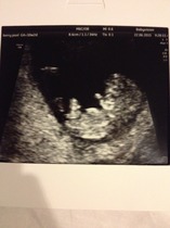 Jan 2016 #4 - heading for the end of the 1st trimester with dating scans and wacky dreams