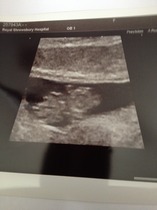 Jan 2016 #4 - heading for the end of the 1st trimester with dating scans and wacky dreams