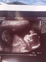Boy or girl? Nub experts?